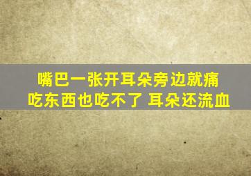 嘴巴一张开耳朵旁边就痛 吃东西也吃不了 耳朵还流血